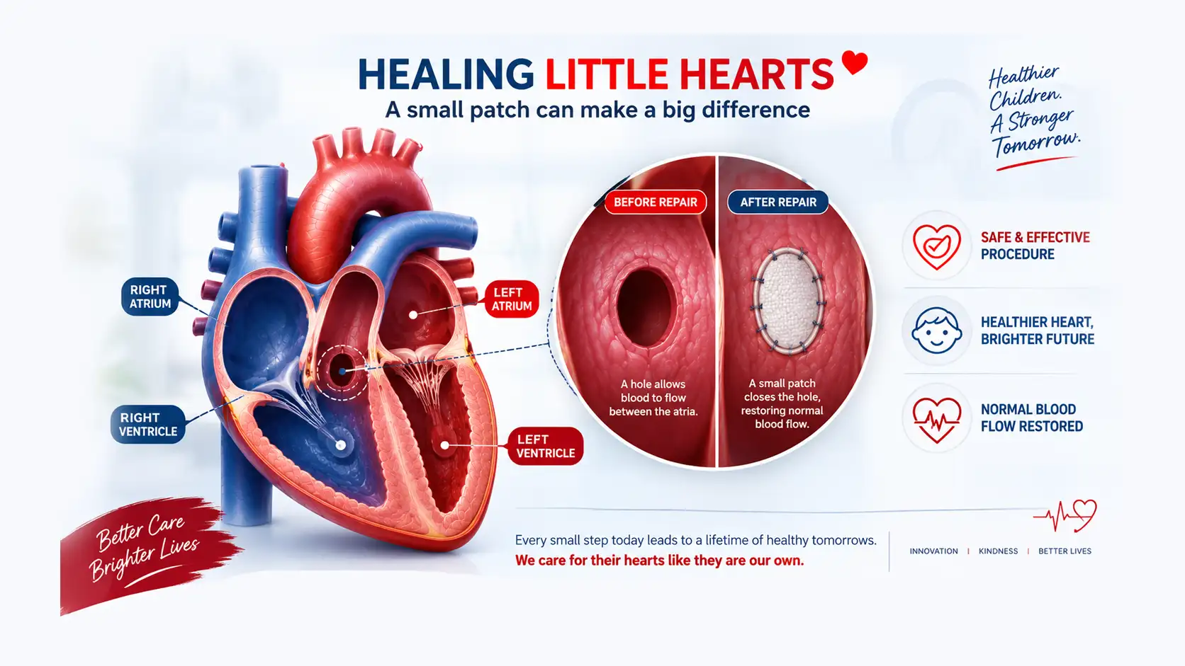 Congenital Heart Surgery (Defect Repairs)